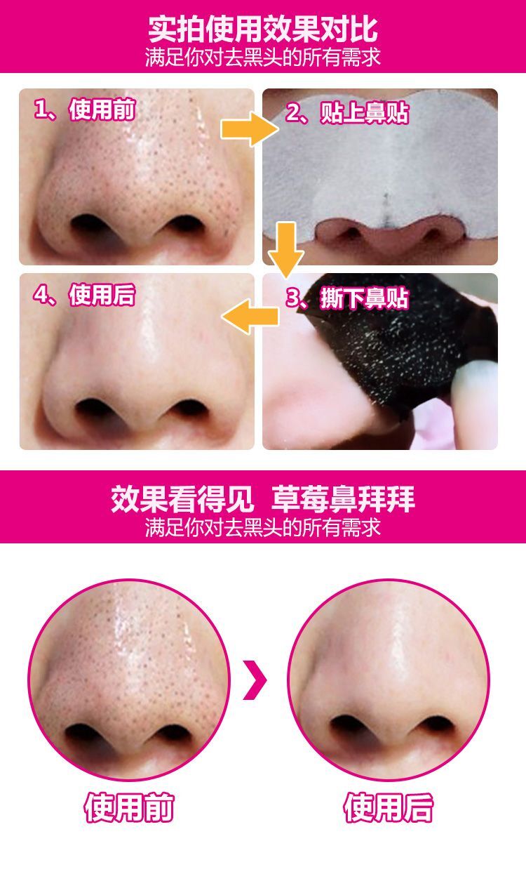 QS-103 - HAYUE Charcoal Blackhead Nose Mask - Image 3